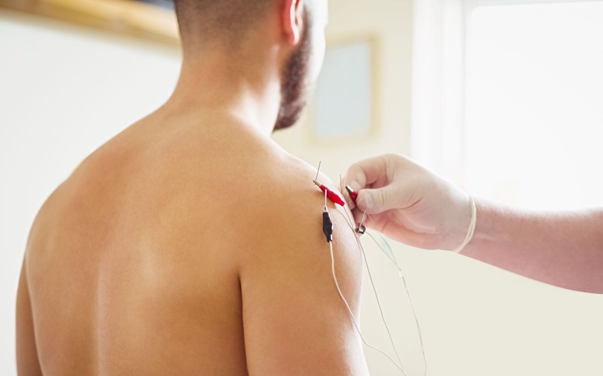 tratamentos de acupuntura ericeira