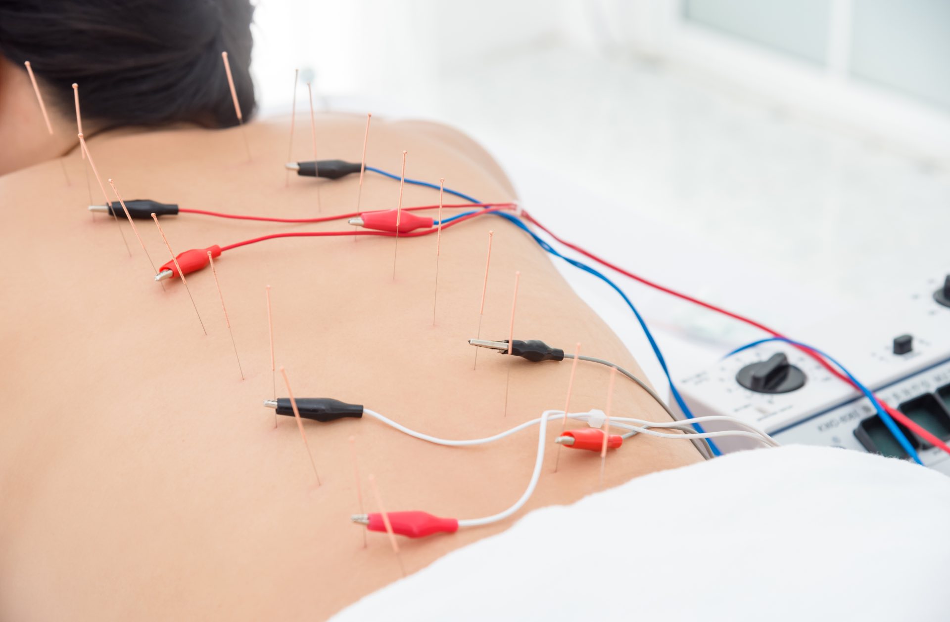 João Fialho Pereira acupuntura fitoterapia malveira